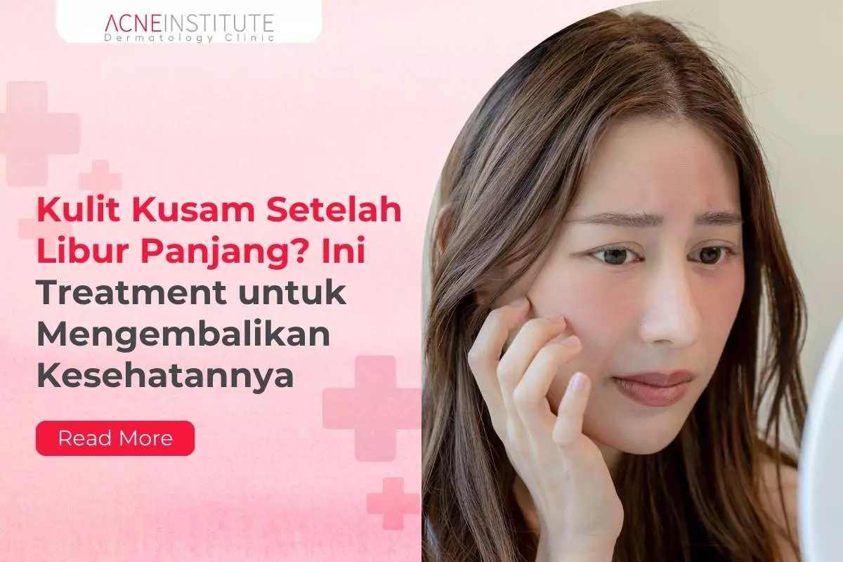 Kulit Kusam Setelah Libur Panjang? Ini Treatment untuk Mengembalikan Kesehatannya