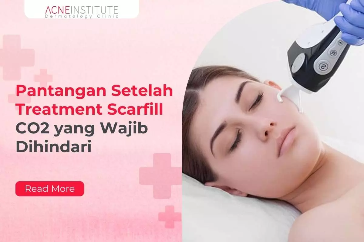 Pantangan Setelah Treatment Scarfill CO2 yang Wajib Dihindari