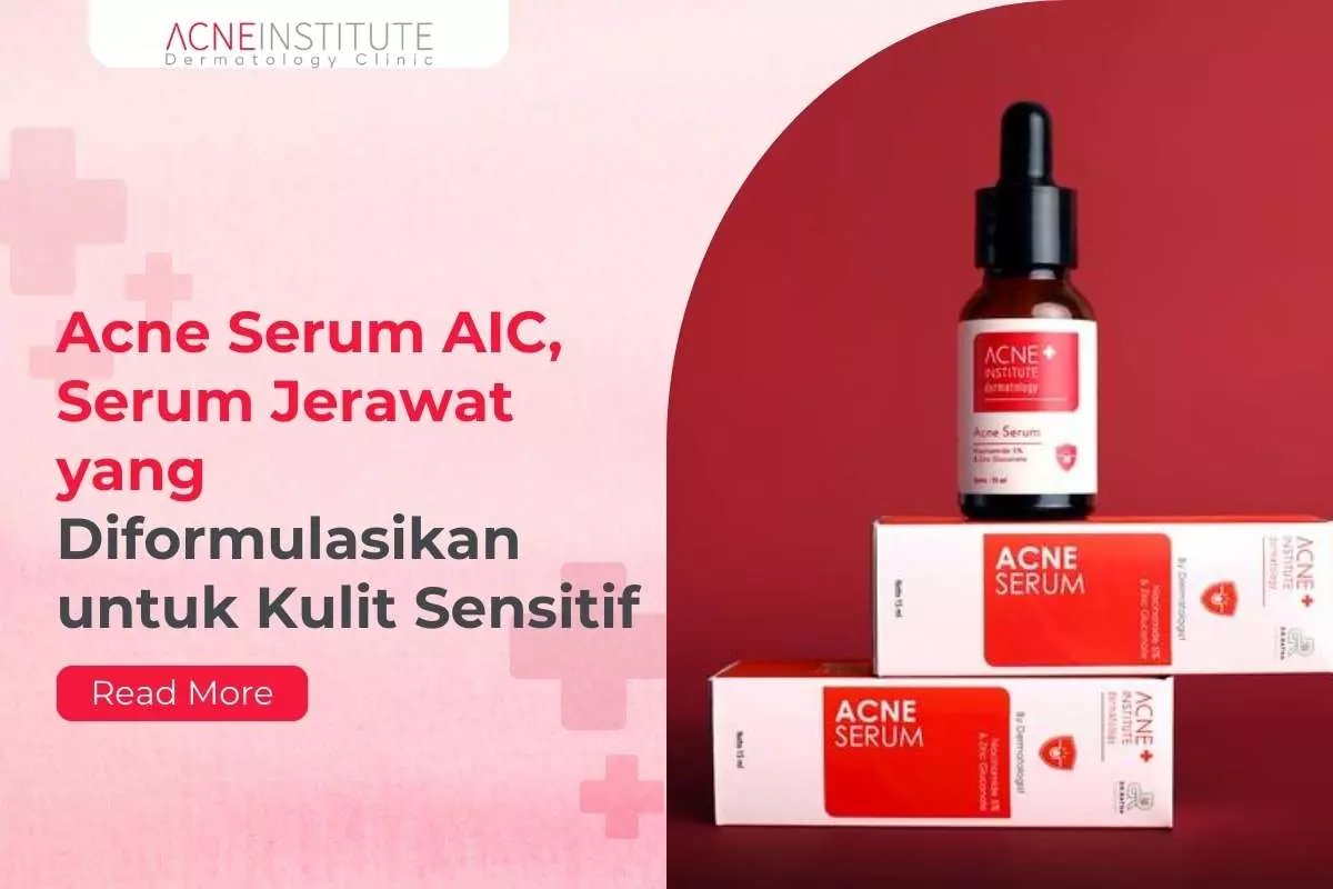 Acne Serum AIC,  Serum Jerawat yang Diformulasikan untuk Kulit Sensitif