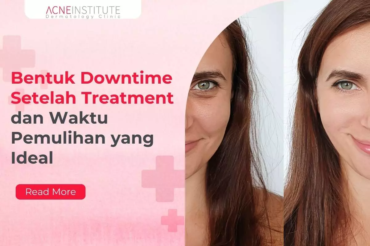 Bentuk Downtime Setelah Treatment dan Waktu Pemulihan yang Ideal
