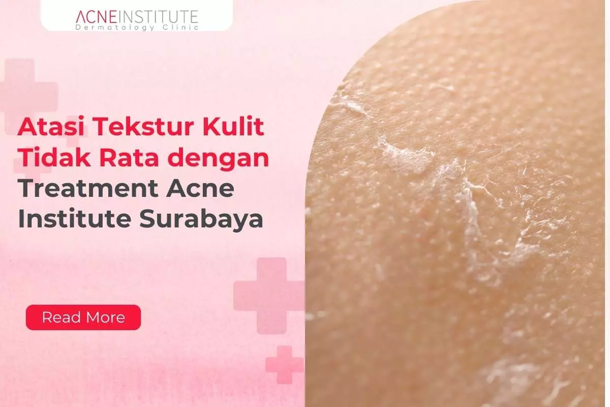 Atasi Tekstur Kulit Tidak Rata dengan Treatment Acne Institute Surabaya