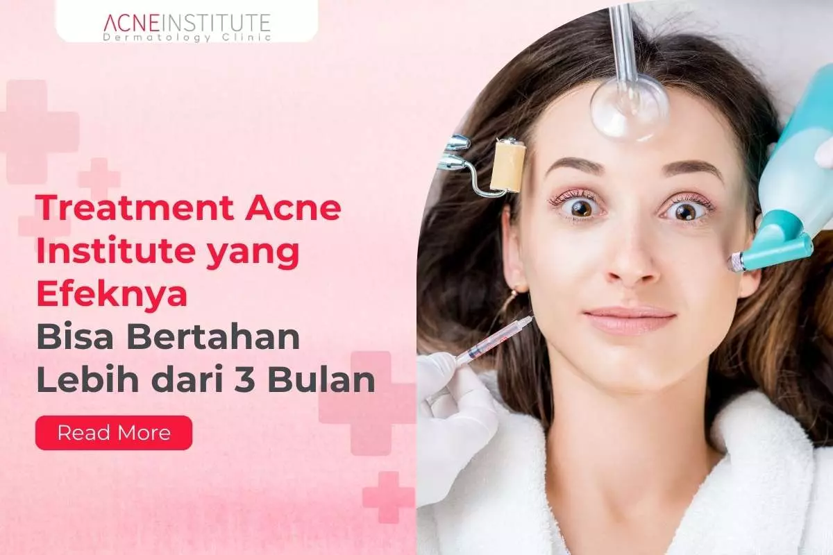 Treatment Acne Institute yang Efeknya Bisa Bertahan Lebih dari 3 Bulan