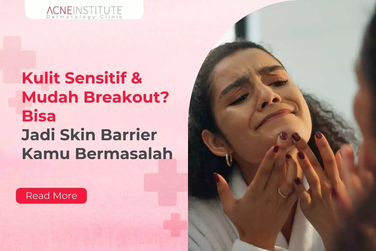 Kulit Sensitif & Mudah Breakout? Bisa Jadi Skin Barrier Kamu Bermasalah