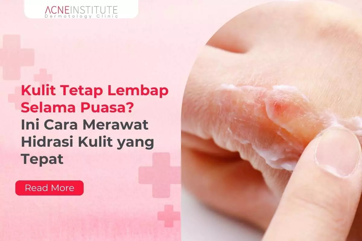 Kulit Tetap Lembap Selama Puasa? Ini Cara Merawat Hidrasi Kulit yang Tepat