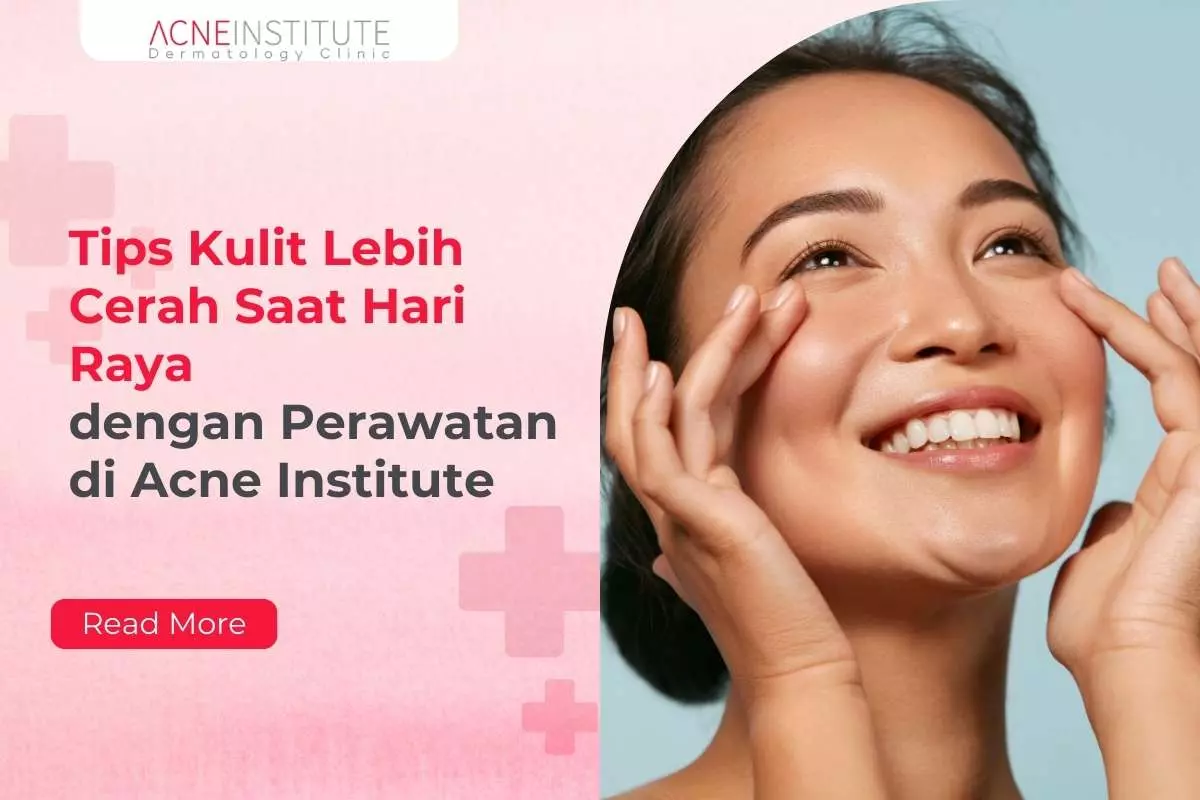 Tips Kulit Lebih Cerah Saat Hari Raya dengan Perawatan di Acne Institute