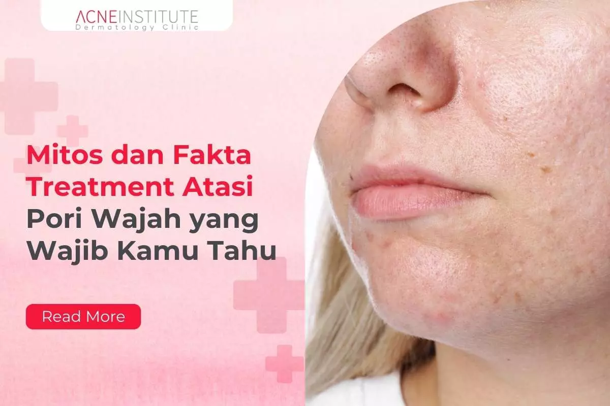 Mitos dan Fakta Treatment Atasi Pori Wajah yang Wajib Kamu Tahu