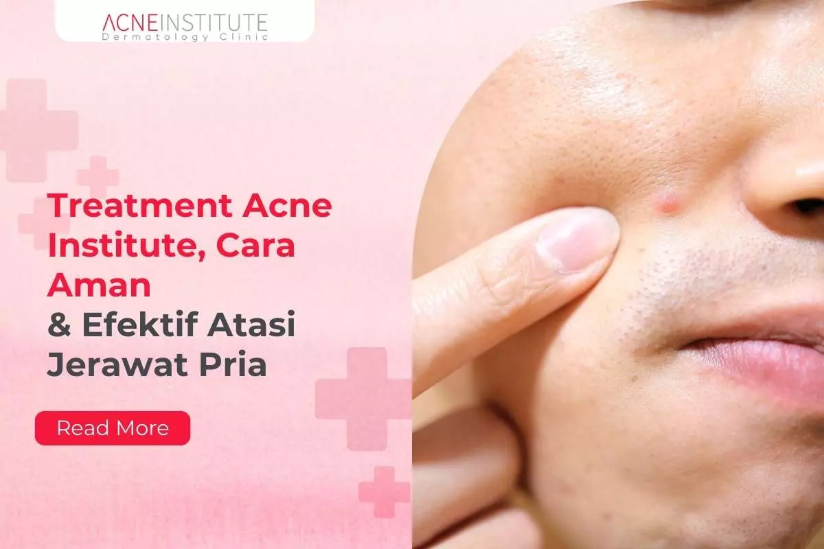 Treatment Acne Institute, Cara Aman & Efektif Atasi Jerawat Pria
