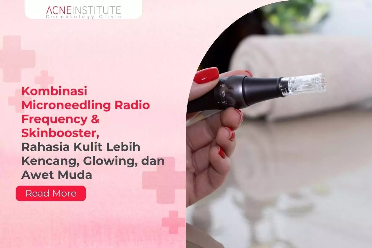 Kombinasi Microneedling Radio Frequency & Skinbooster, Rahasia Kulit Lebih Kencang, Glowing, dan Awet Muda
