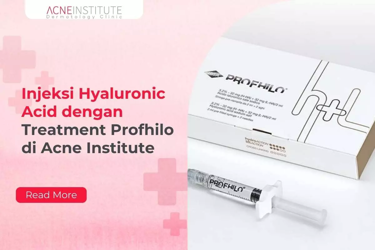 Injeksi Hyaluronic Acid dengan Treatment Profhilo di Acne Institute