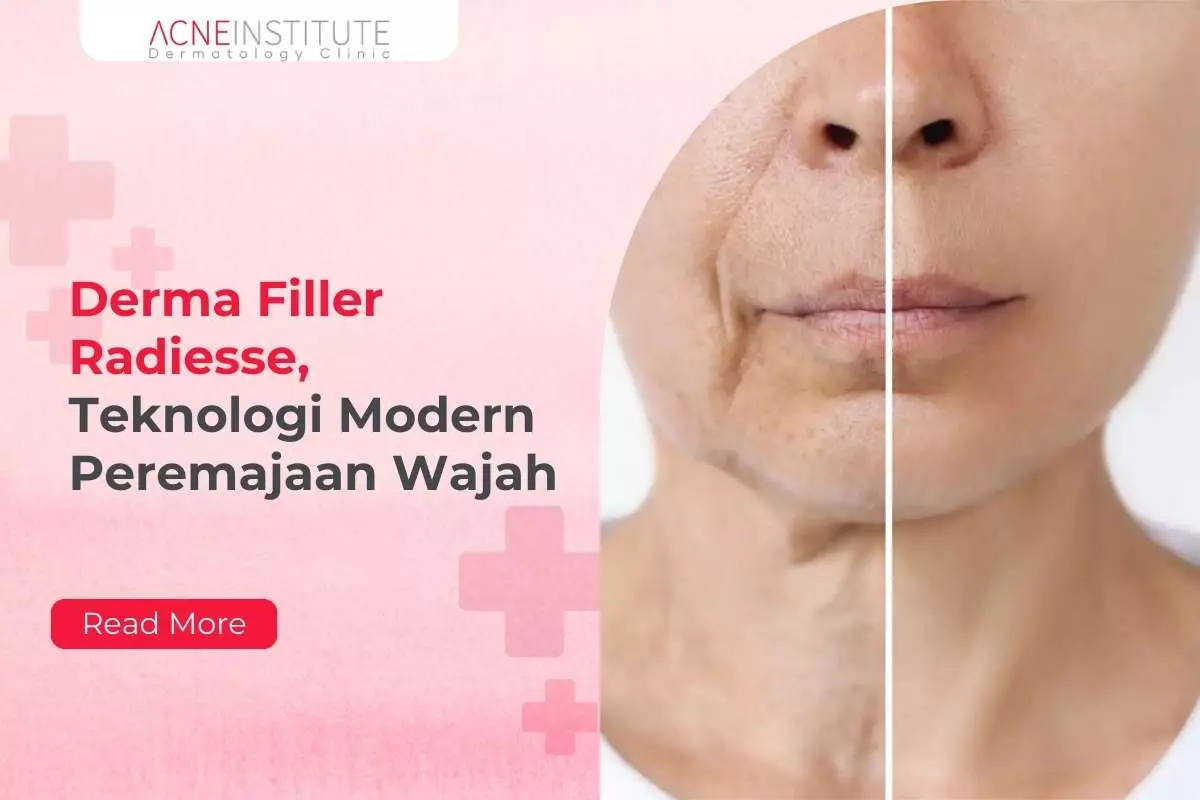 Derma Filler Radiesse, Teknologi Modern Peremajaan Wajah
