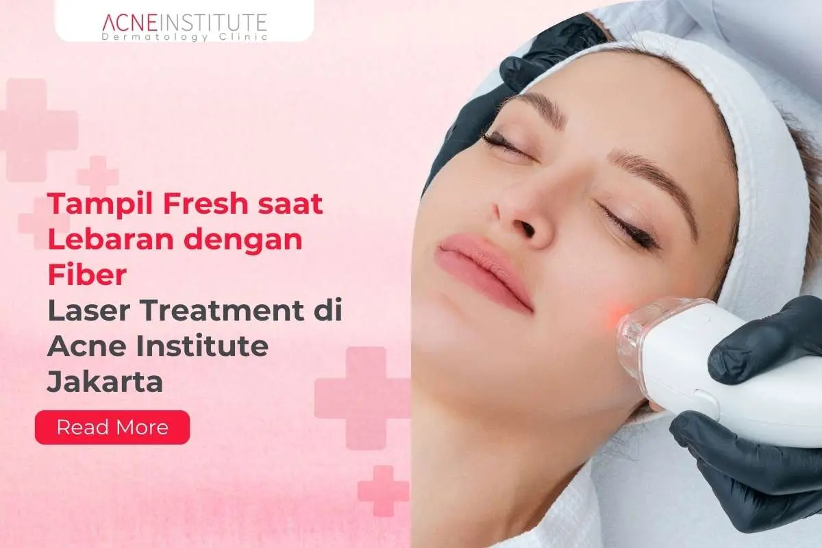 Tampil Fresh saat Lebaran dengan Fiber Laser Treatment di Acne Institute Jakarta