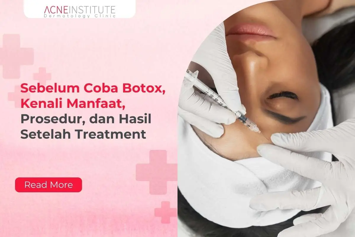 Sebelum Coba Botox, Kenali Manfaat, Prosedur, dan Hasil Setelah Treatment