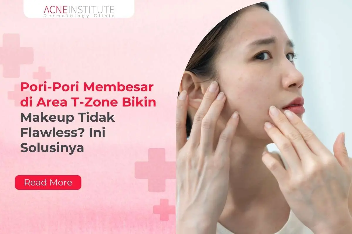 Pori-Pori Membesar di Area T-Zone Bikin Makeup Tidak Flawless? Ini Solusinya