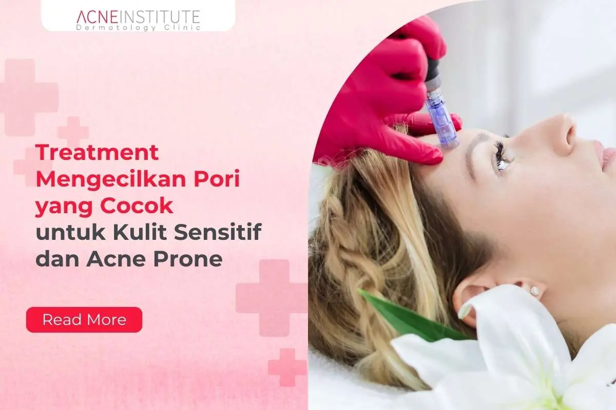 Treatment Mengecilkan Pori yang Cocok untuk Kulit Sensitif dan Acne Prone