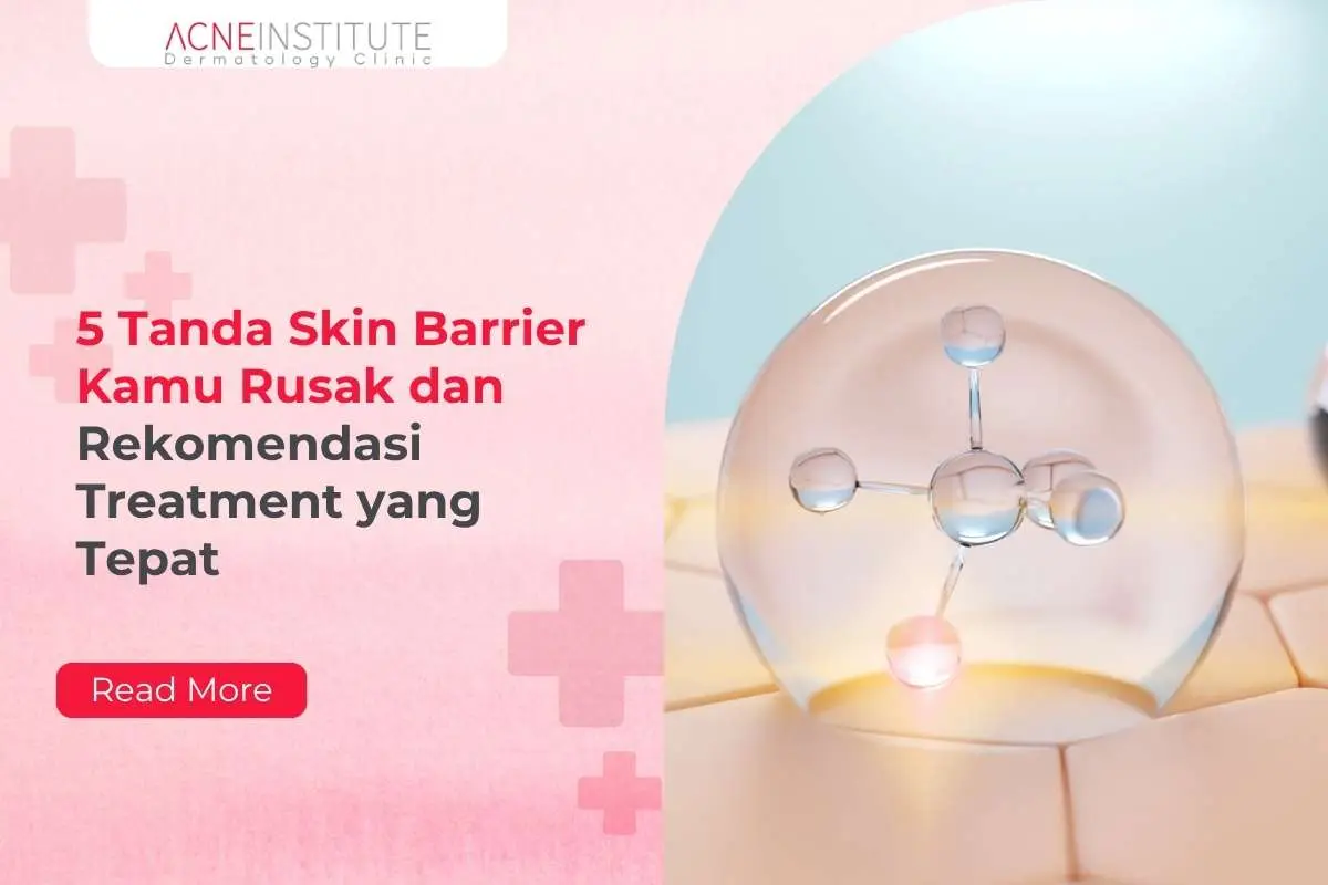 5 Tanda Skin Barrier Kamu Rusak dan Rekomendasi Treatment yang Tepat