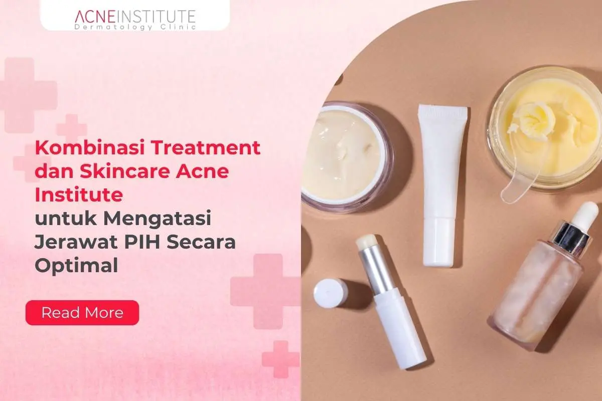 Kombinasi Treatment dan Skincare Acne Institute untuk Mengatasi Jerawat PIH Secara Optimal