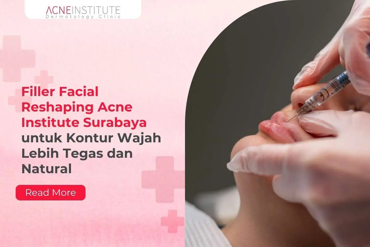 Filler Facial Reshaping Acne Institute Surabaya untuk Kontur Wajah Lebih Tegas dan Natural