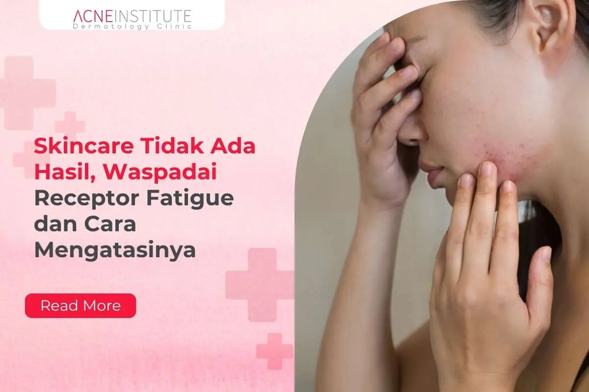 Skincare Tidak Ada Hasil, Waspadai Receptor Fatigue dan Cara Mengatasinya