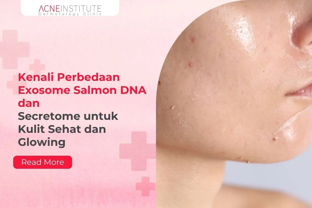 Kenali Perbedaan Exosome Salmon DNA dan Secretome untuk Kulit Sehat dan Glowing