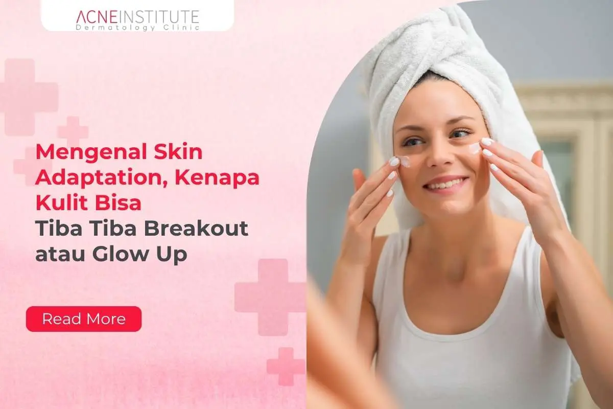 Mengenal Skin Adaptation, Kenapa Kulit Bisa Tiba Tiba Breakout atau Glow Up