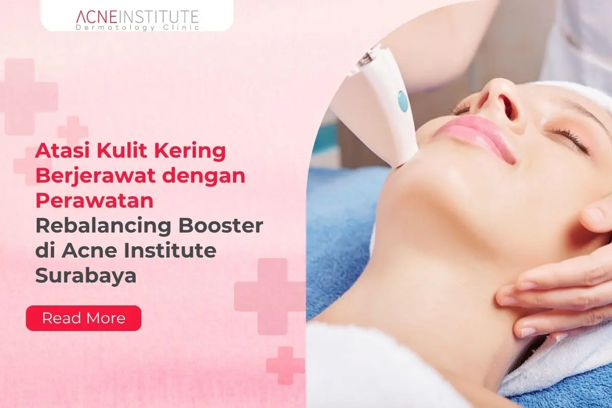 Atasi Kulit Kering Berjerawat dengan Perawatan Rebalancing Booster di Acne Institute Surabaya