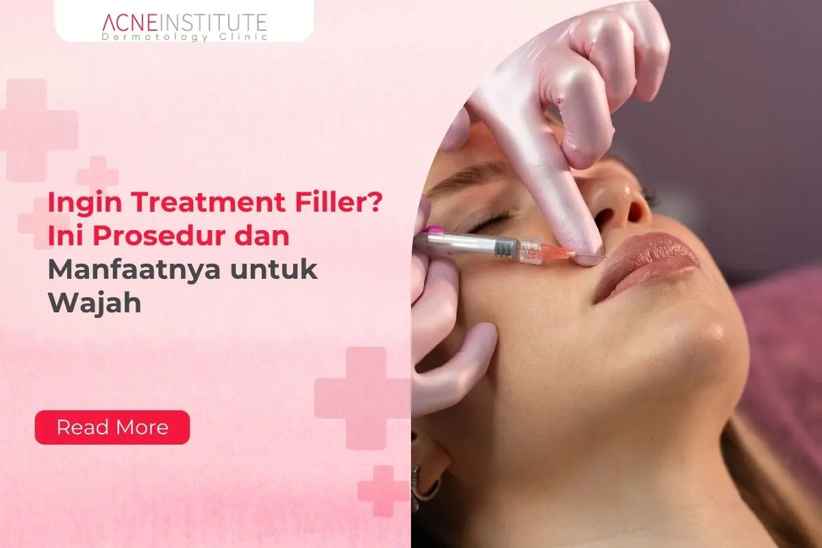 Ingin Treatment Filler? Ini Prosedur dan Manfaatnya untuk Wajah