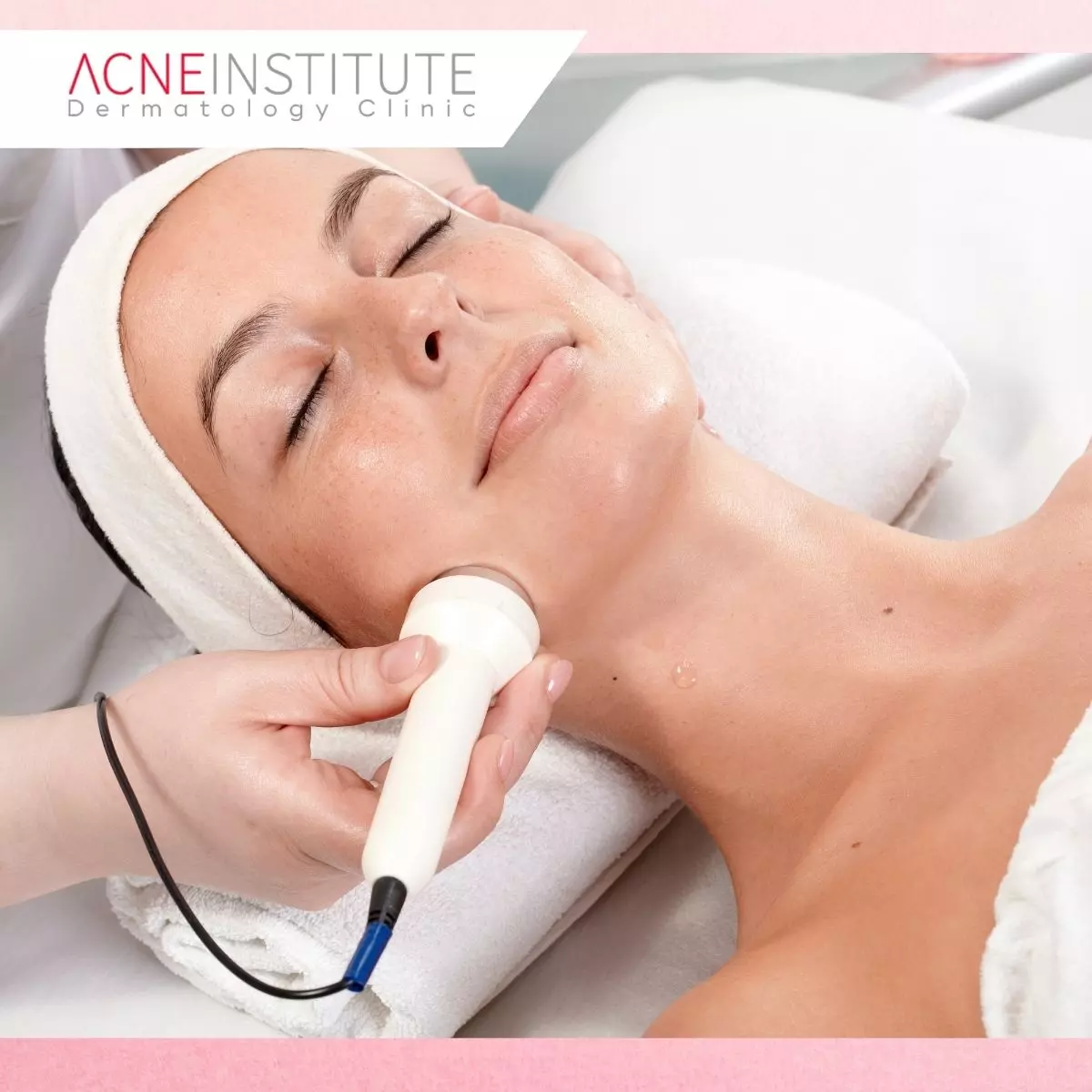 Jenis Perawatan Jerawat di Acne Institute Jakarta