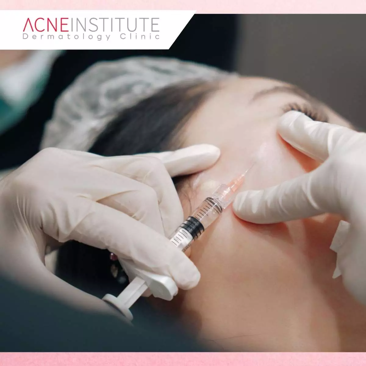 Cara Kerja Treatment Juvelook