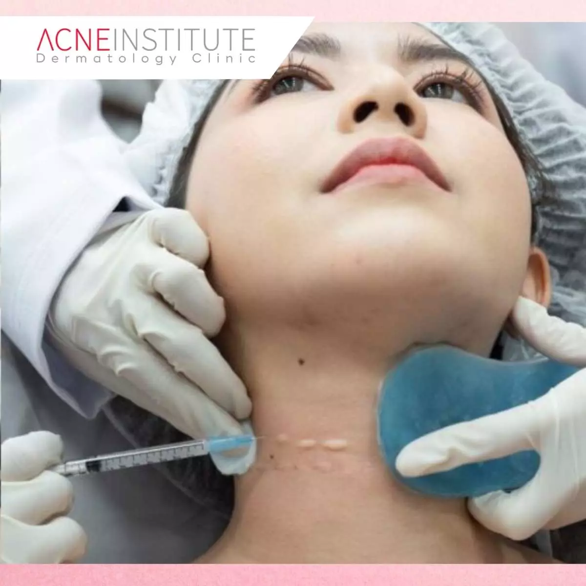 Durasi Treatment yang Dibutuhkan