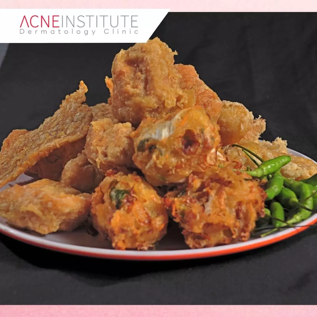 3. Makanan Penyebab Jerawat dari Makanan Berminyak dan Gorengan