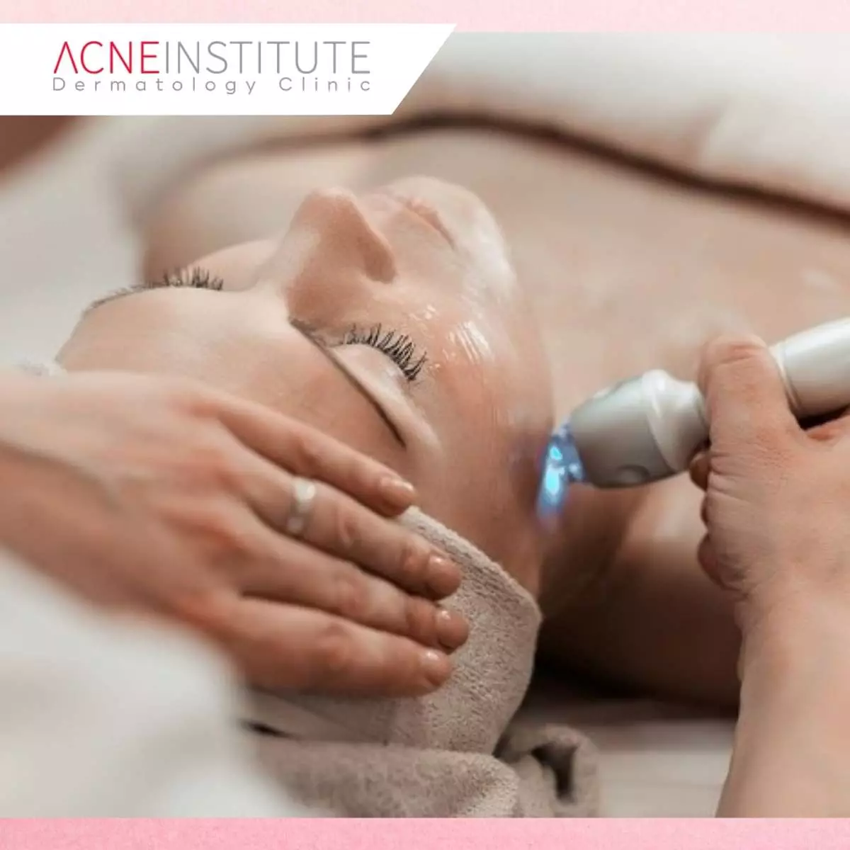 Keunggulan Fiber Laser Treatment, Solusi Perawatan Kulit Modern