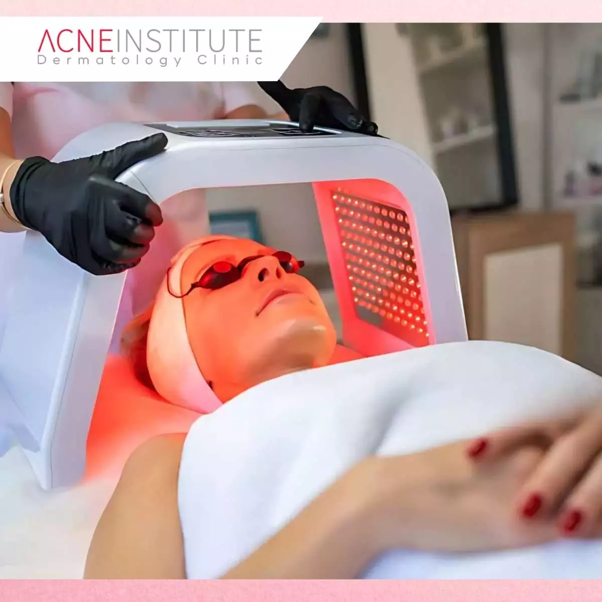 Kenapa Memilih Acne Institute Jakarta?
