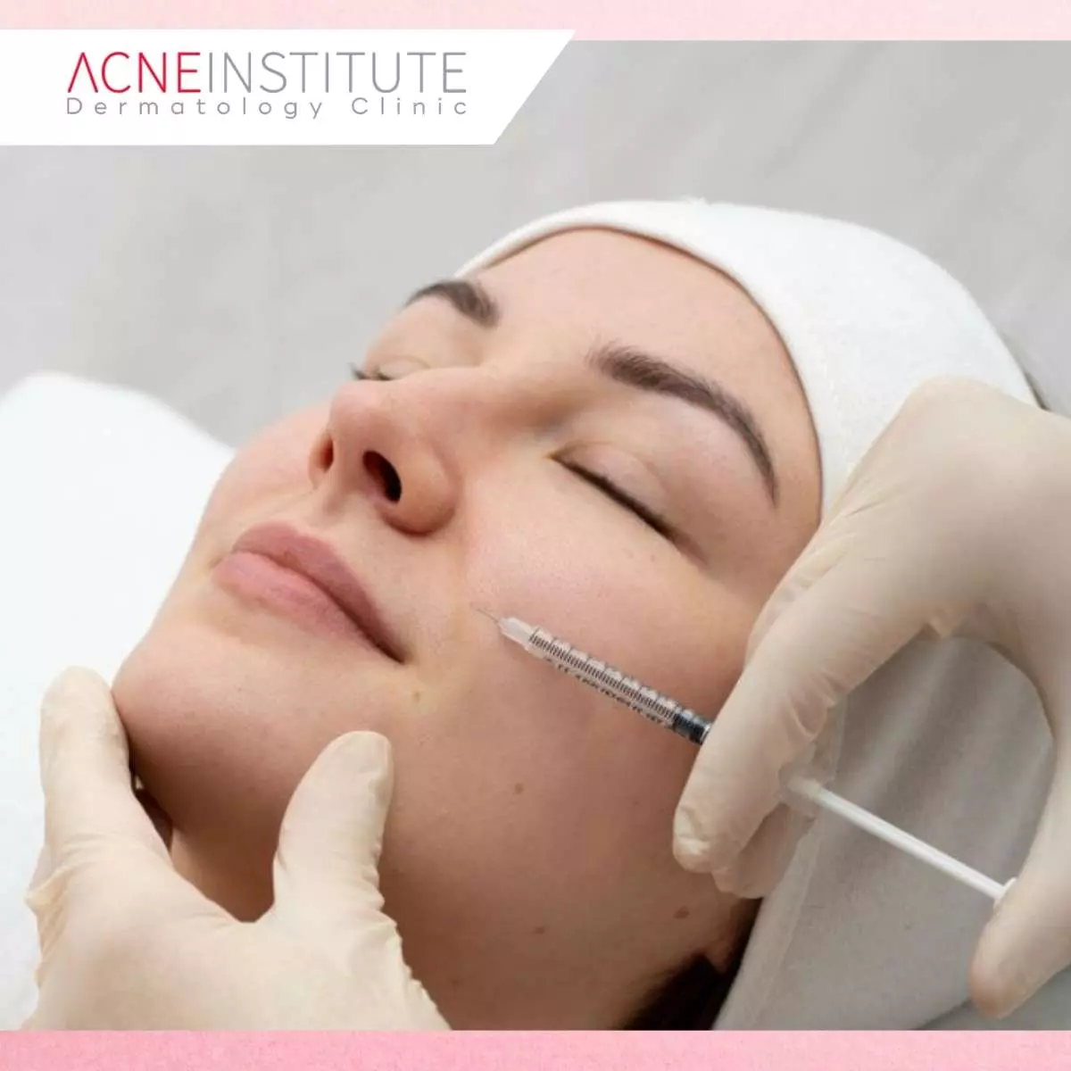 Durasi Hasil Collagen Stimulator