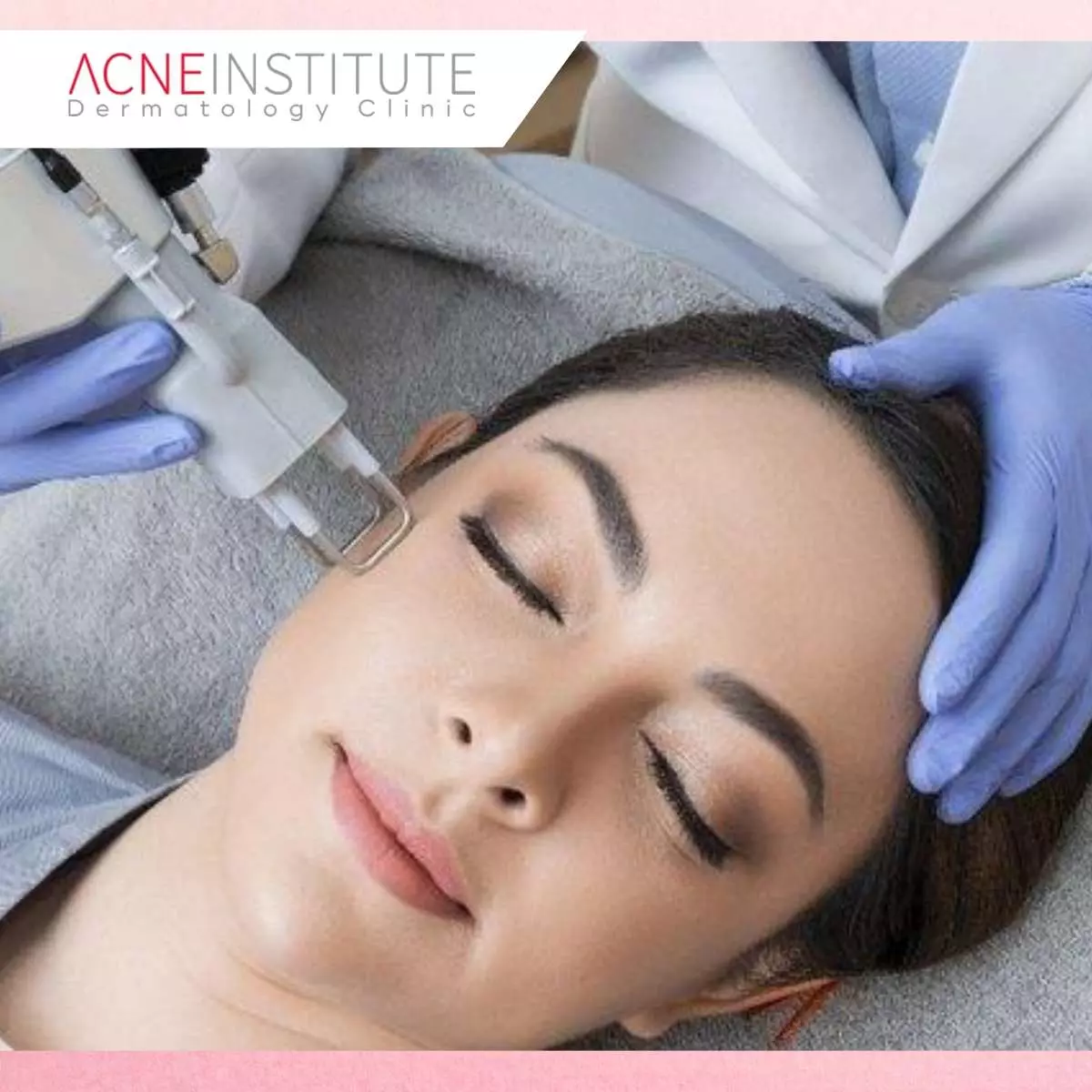 Tips Memilih Treatment yang Tepat