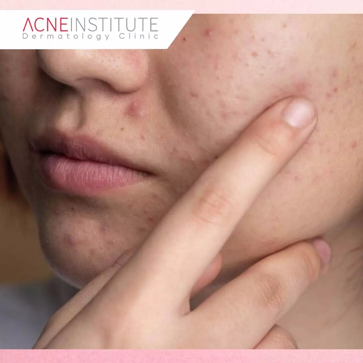 Treatment Skin Health: Kunci Kulit Sehat, Lembap, dan Terlindungi