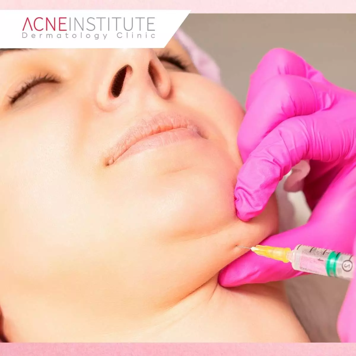 Cara Menghilangkan Double Chin Tanpa Operasi