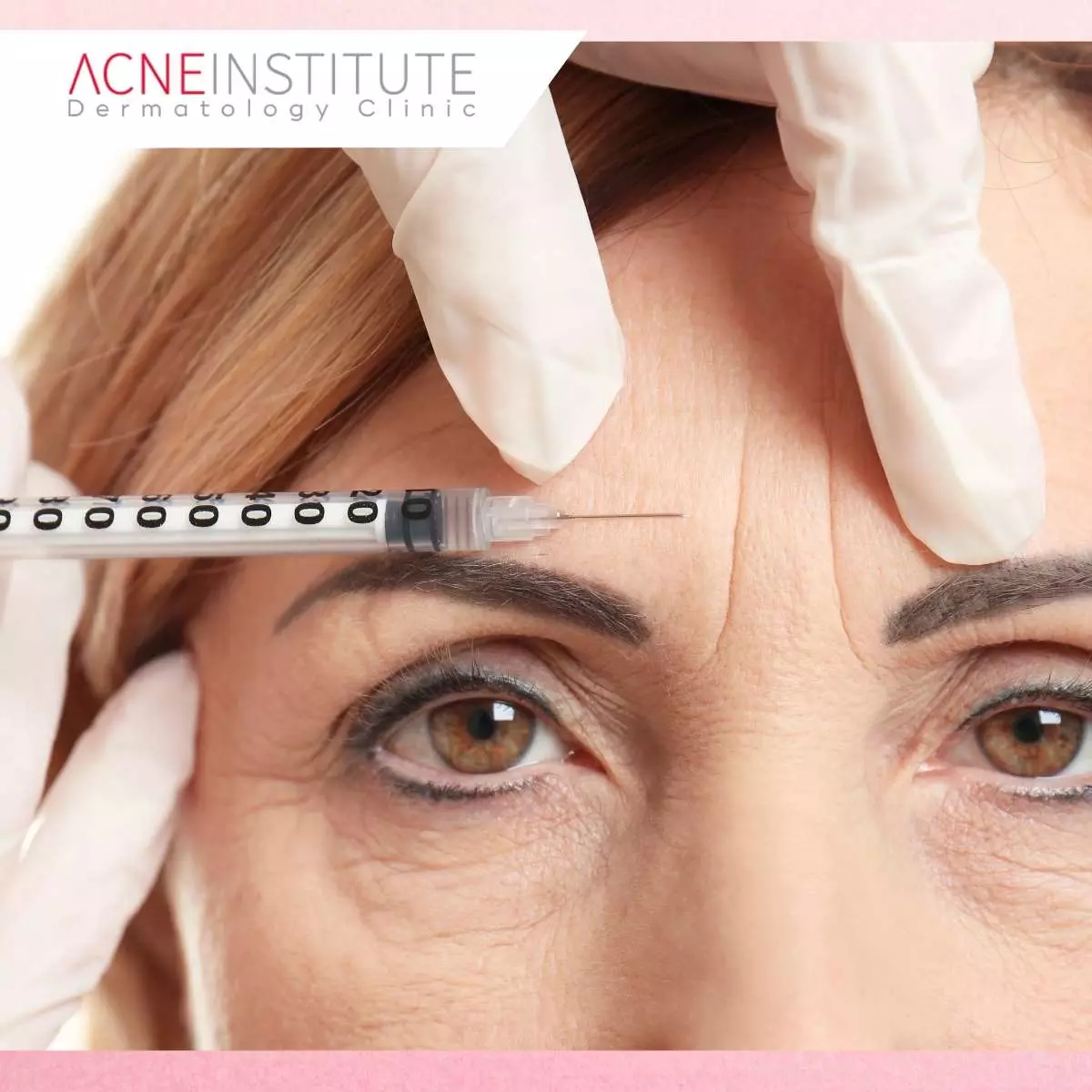Keuntungan dari Kombinasi Kedua Treatment