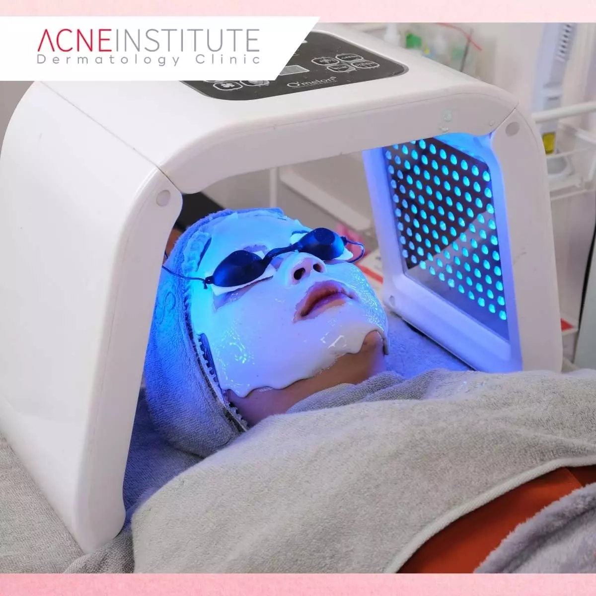 Apa Itu Treatment Wajah Non Invasif?