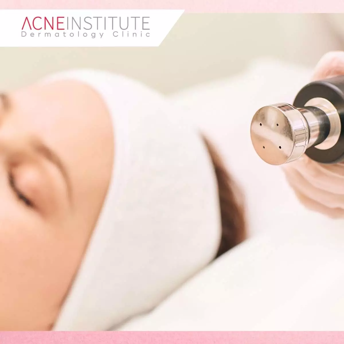 Treatment Wajah Non Invasif di Acne Institute Surabaya