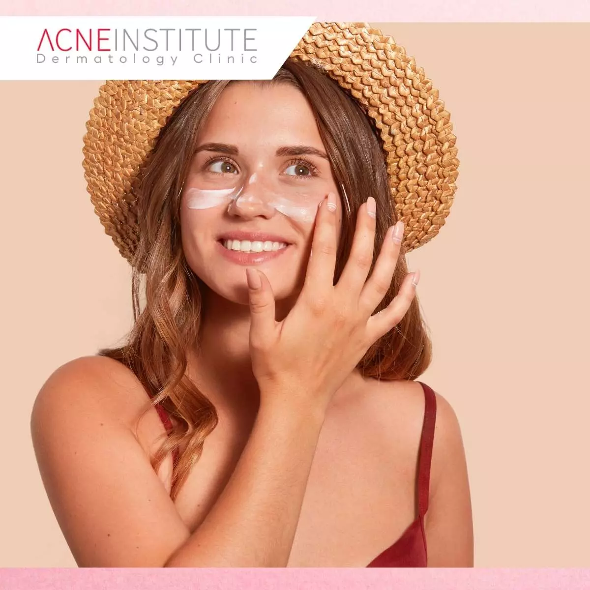 Pentingnya Memilih Sunscreen yang Tepat untuk Kulit Berjerawat