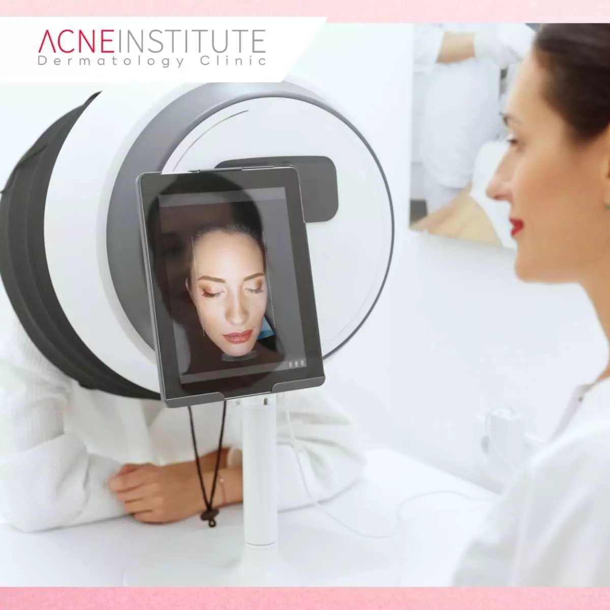 Persiapan Sebelum Treatment Acne Scar Correction