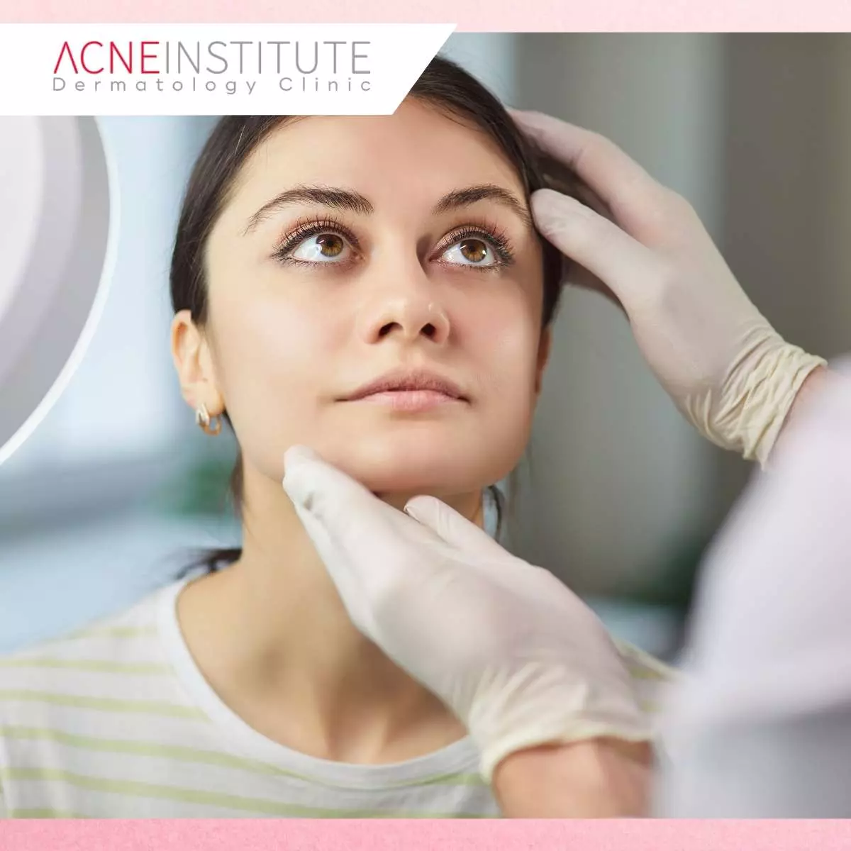 Proses Treatment Dark Spot di Acne Institute