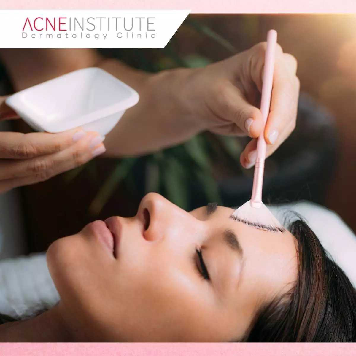 Treatment yang Harus Dihindari Jika Memiliki Kulit Berjerawat