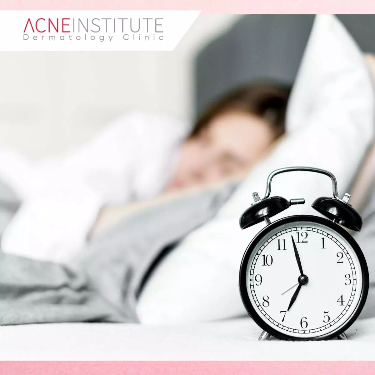 Hubungan Langsung antara Kualitas Tidur dan Kulit Berjerawat