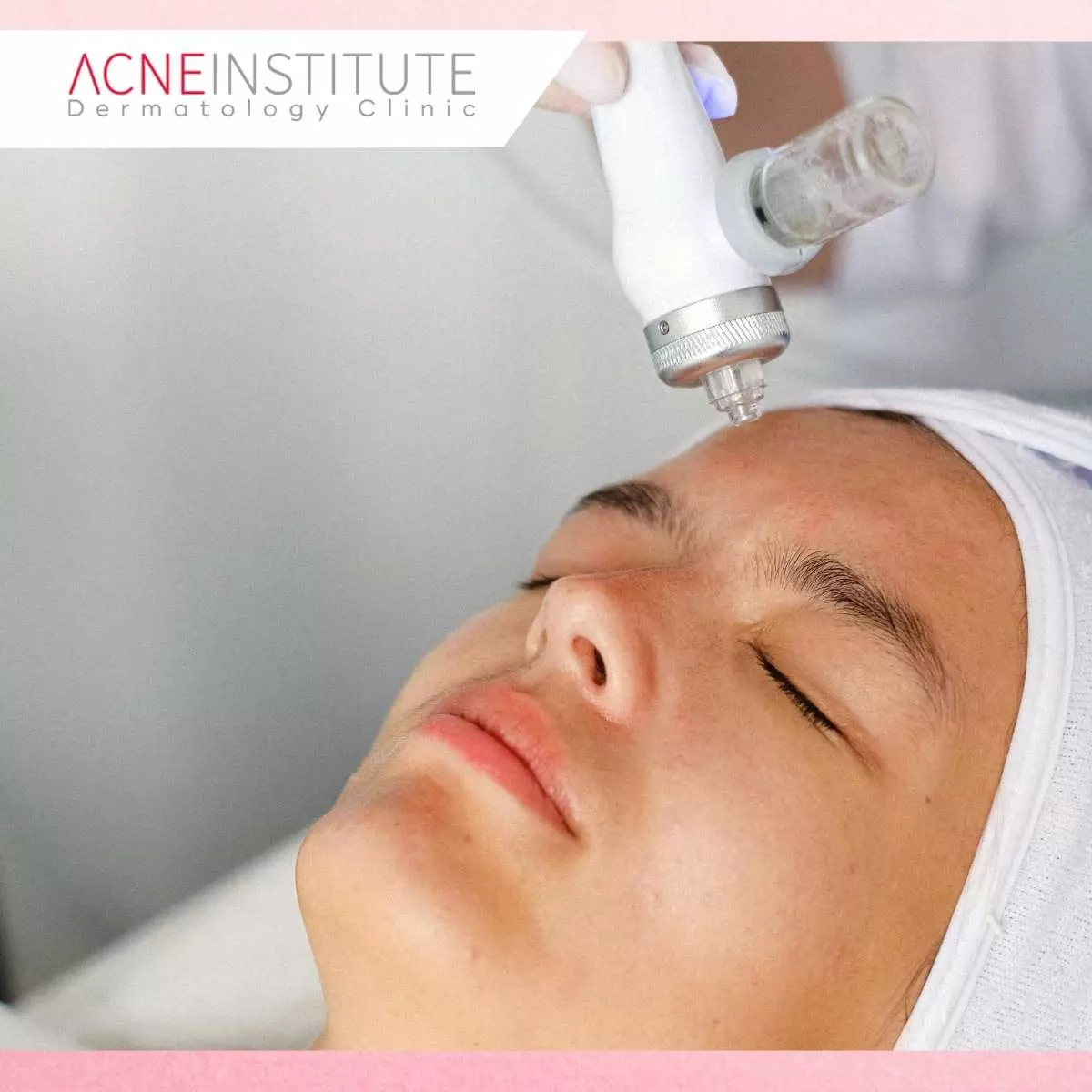 Kombinasi Laser, Microneedling & Produk Topikal: Efek Sinergis yang Optimal
