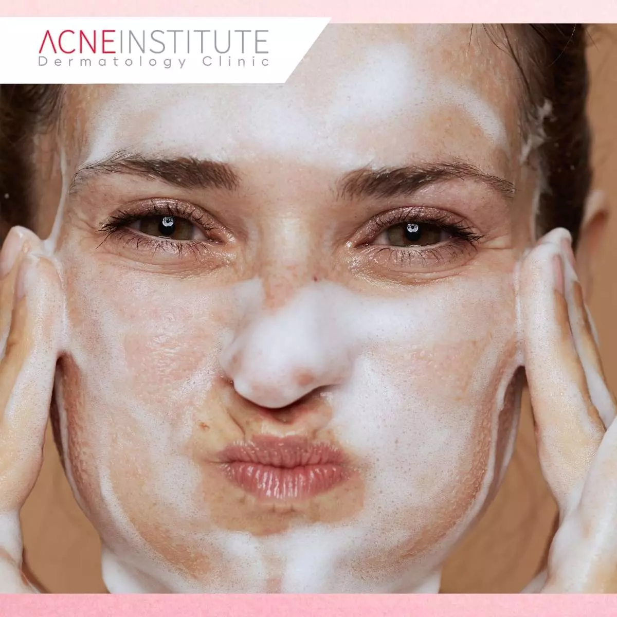 Cara Pemakaian Acne Serum AIC untuk Hasil Maksimal