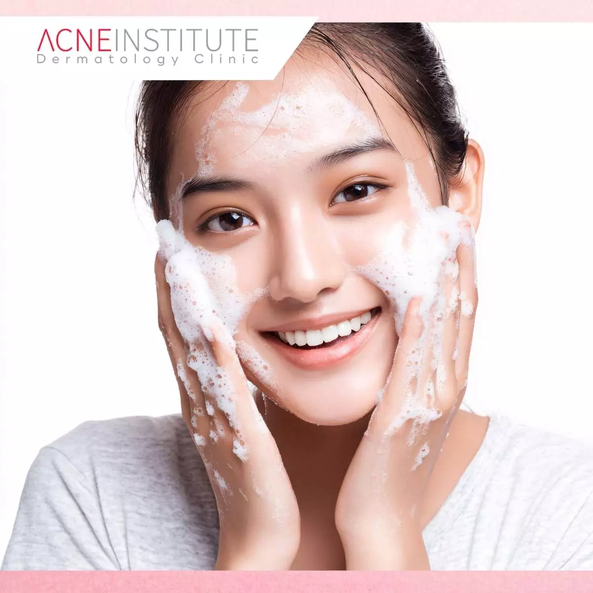 Langkah Dasar Perawatan Kulit Pasca Treatment Jerawat