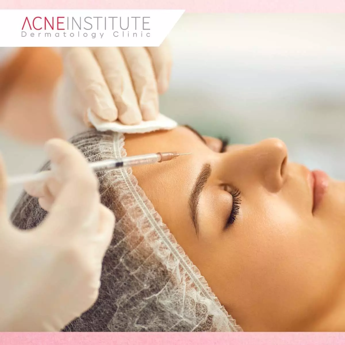 Pentingnya Treatment Sebelum Nikah untuk Kulit yang Sempurna