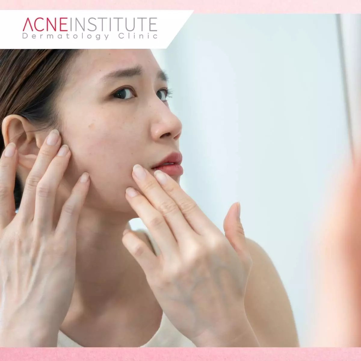 Tips Perawatan Pasca-Treatment