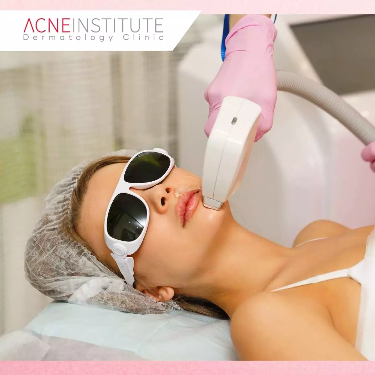 Tips Perawatan Setelah Treatment Laser